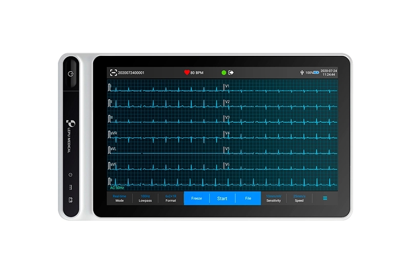 Aplicaciones clínicas del monitoreo de ECg portátil para el diagnóstico de enfermedades cardíacas